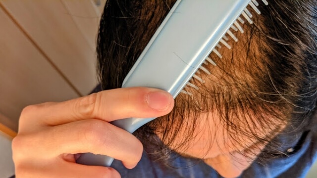 初期脱毛が終わる兆候はある？症状がひどい場合の対処法を解説