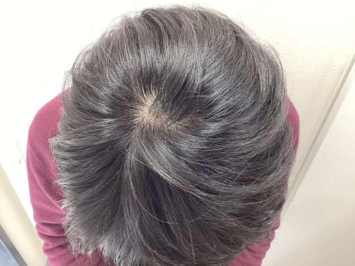 after