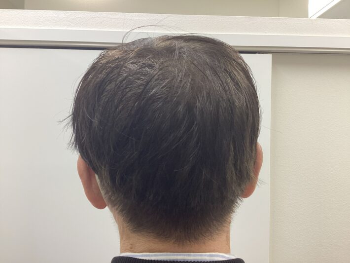 after