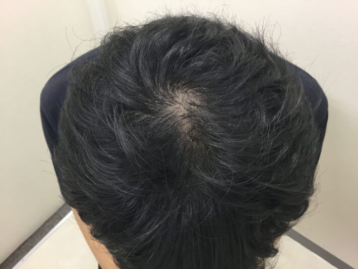 after