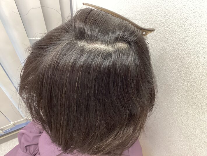 after