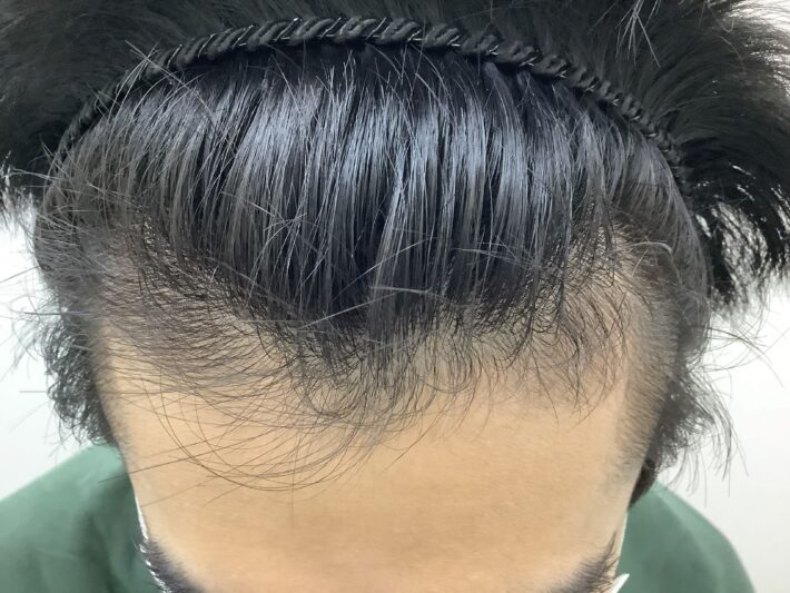 after