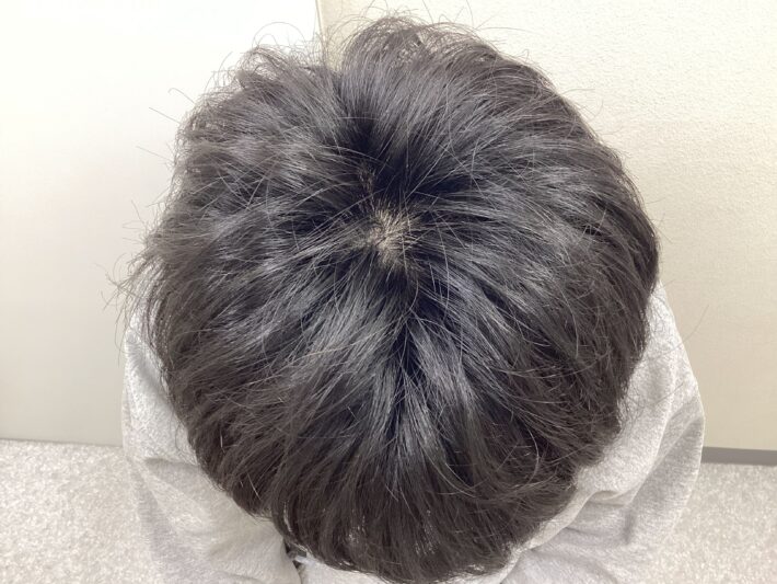 after