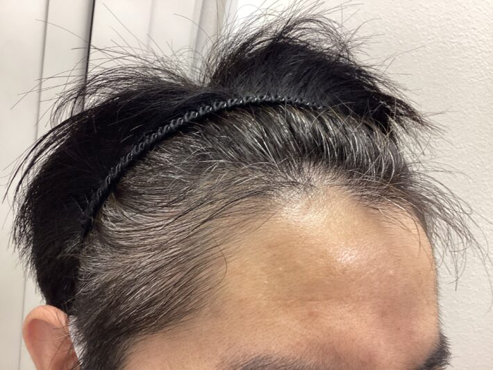 after
