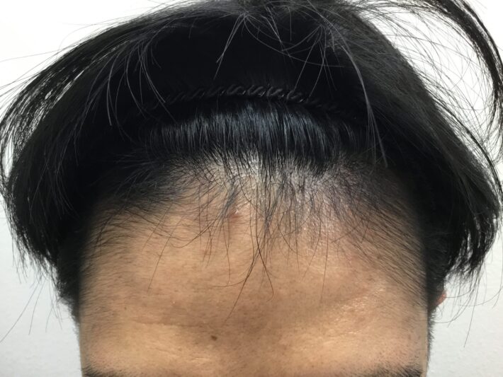 after