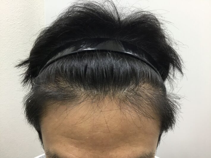 after