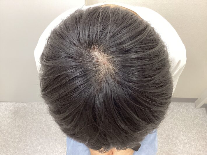 after