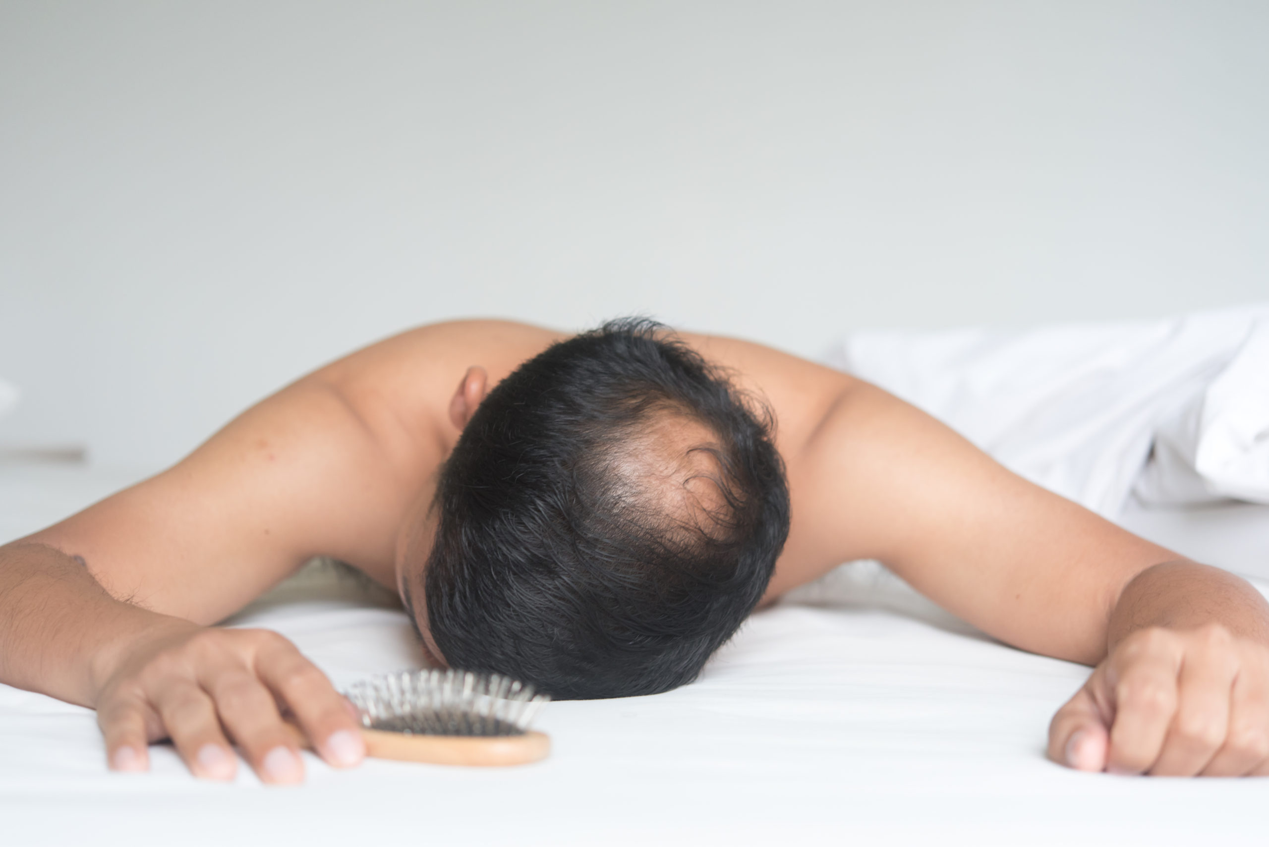 Asian man   are worried   with hair loss problem on the bed at h
