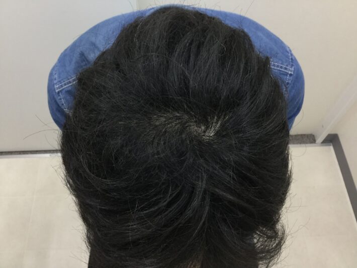 after