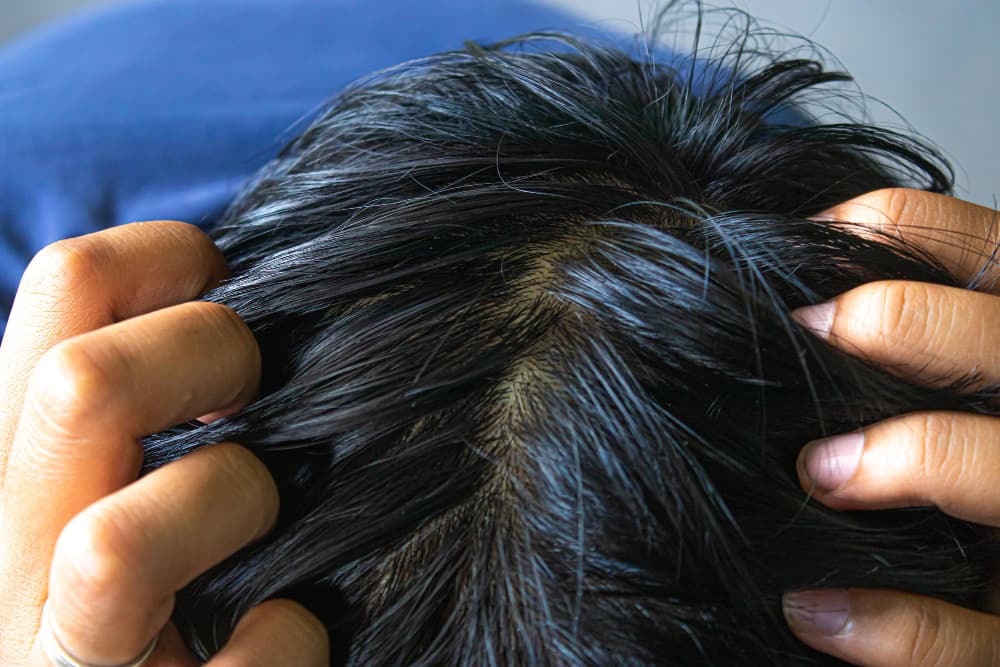 closeup-of-thick-hair-on-the-scalp-of-a-man39s-head (1)