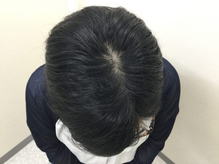 after