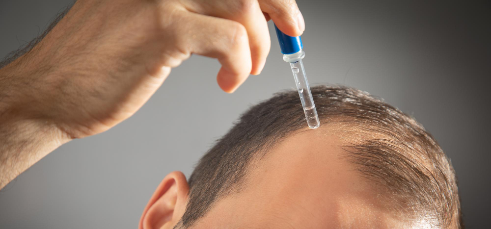 man-applying-dropper-vitamin-on-head-baldness-treatment-concept
