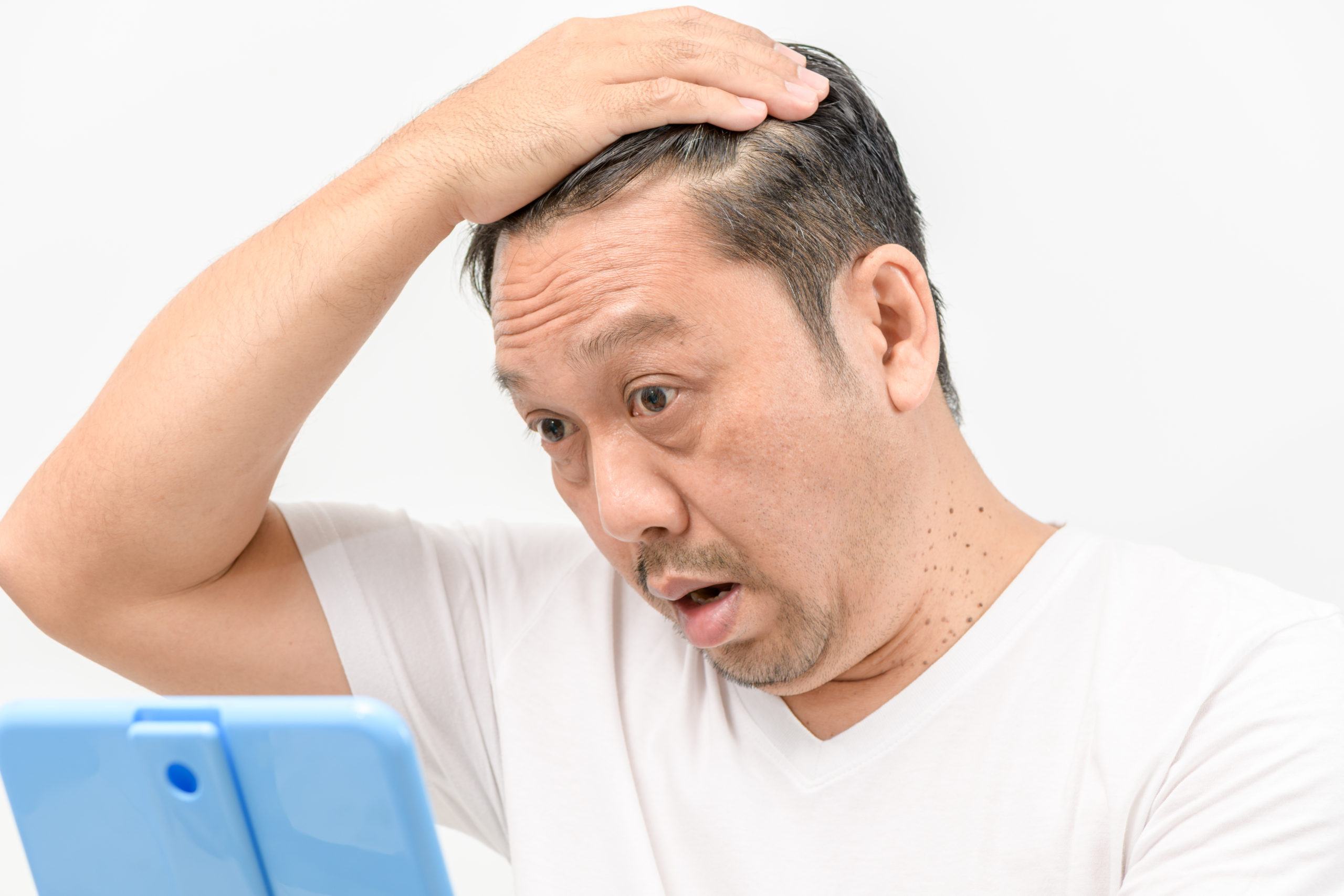 Middle-aged men worry about hair loss or hair growth.